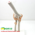 JOINT10 (12357) Médico anatomia ciência natureza tamanho esqueleto articulação do cotovelo modelos incluem ligamentos artificiais flexíveis